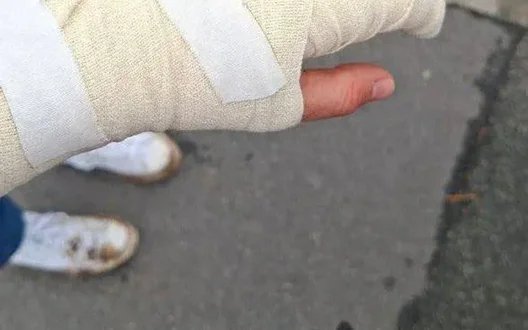 Протести на Теремках: мешканці виступили проти теплотраси, є постраждала