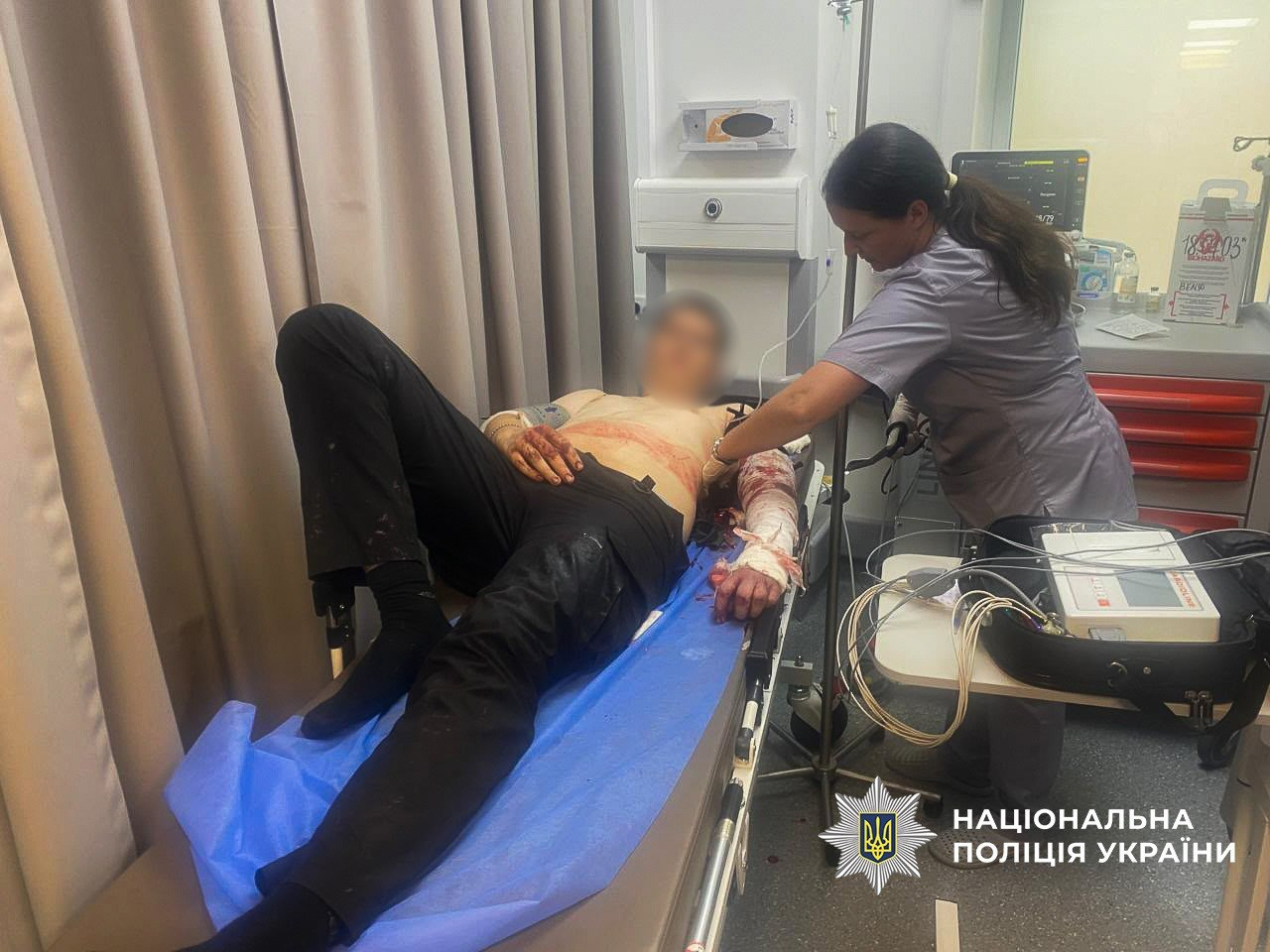 Чоловік з ножем напав на трьох поліцейських у Запоріжжі під час обшуку: нападника застрелили
